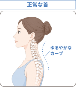 正常な首のイラスト