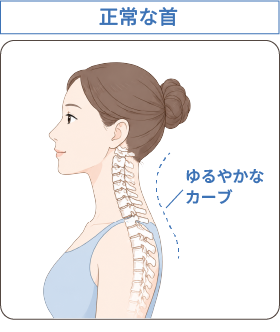 正常な首のカーブを示すイラスト